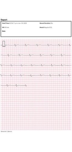 Export ECG